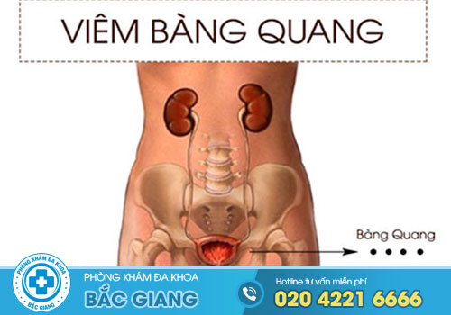 benh-viem-bang-quang-o-nam-nguyen-nhan-va-cach-chua