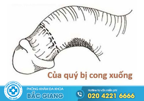 cua-quy-bi-cong-xuong-co-binh-thuong-khong